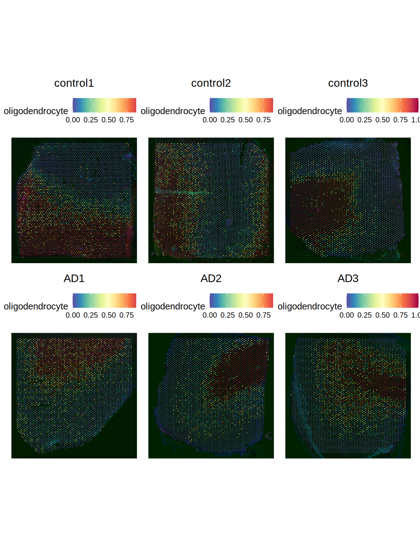Predicted oligodendrocytes